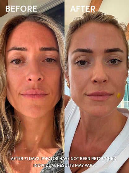 ["Glutathione Serum ", " 33ml // 1.164 fl oz. ", " Before and After Image ", " Uncommon Beauty"]